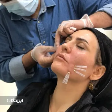 کلینیک زیبایی بلا