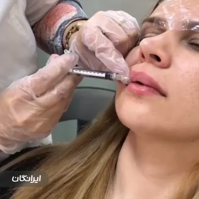 کلینیک زیبایی بلا