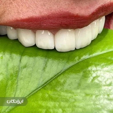 دندانپزشکی آرامیس