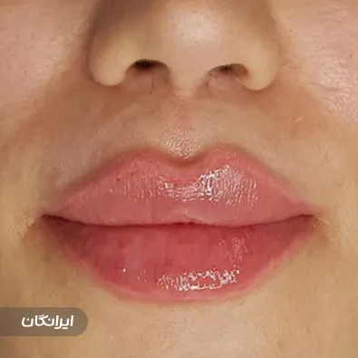 کلینیک زیبایی دکتر نادر یزدان پناه