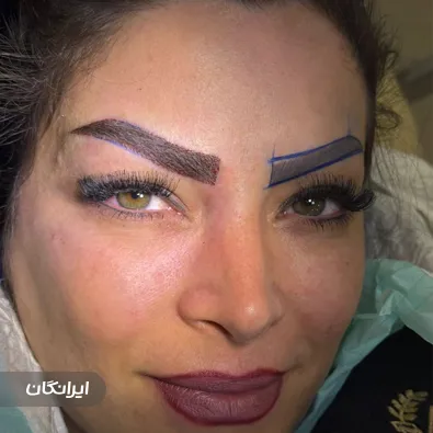 کلینیک زیبایی سنتر