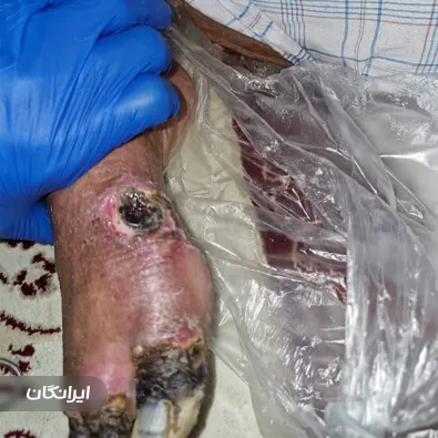 درمانگر زخم فرید راستگو