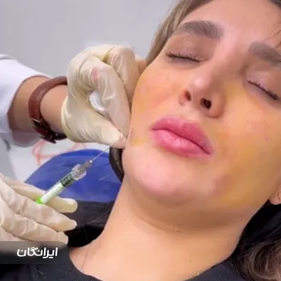 کلینیک زیبایی نارینا