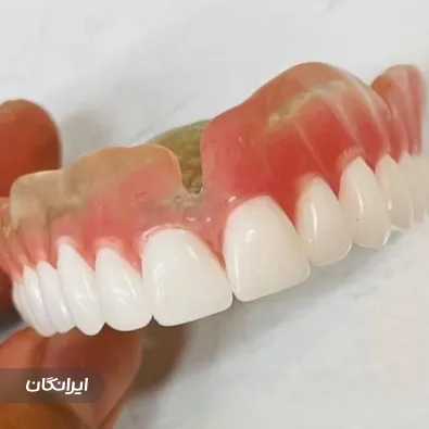 دندانسازی طاها