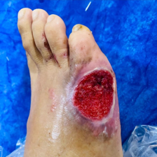 کلینیک زخم دکتر سلطانی