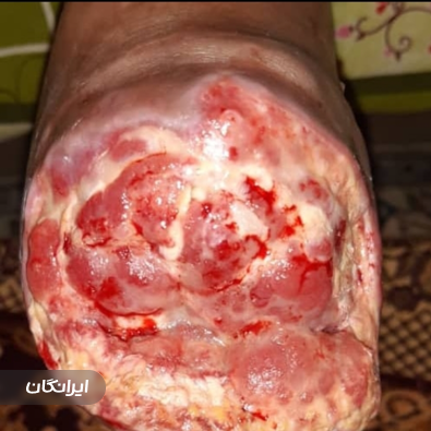 کلینیک زخم دکتر سلطانی