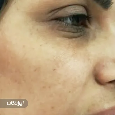 کلینیک زیبایی آنیل