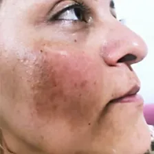 کلینیک زیبایی آنیل