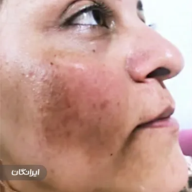 کلینیک زیبایی آنیل