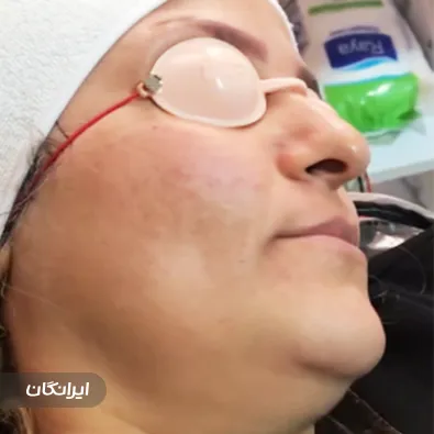 کلینیک زیبایی آنیل