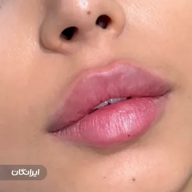 کلینیک زیبایی مانلی