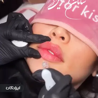 کلینیک زیبایی سامان