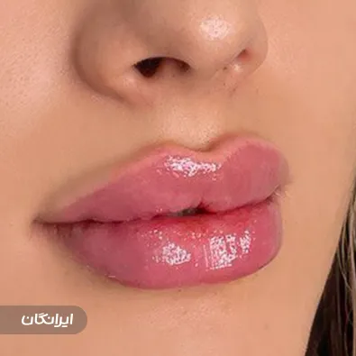 کلینیک زیبایی میست