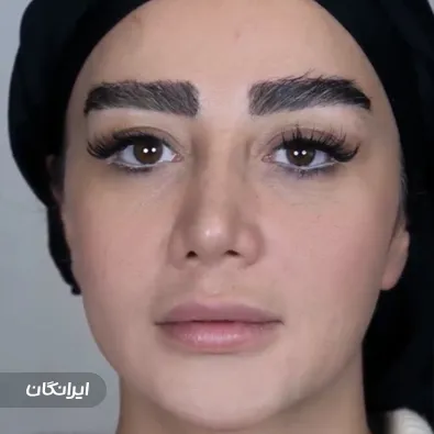 کلینیک زیبایی لمیس لانژ