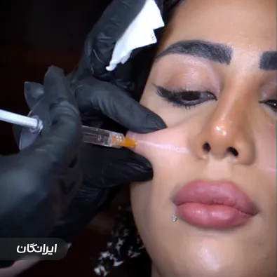 کلینیک زیبایی لمیس لانژ