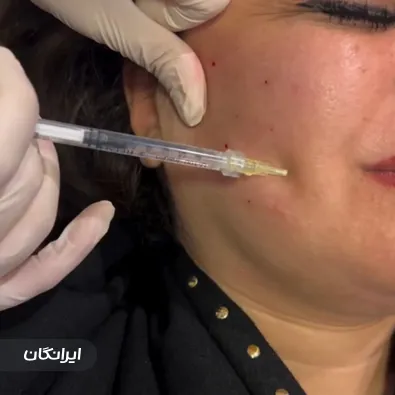 کلینیک زیبایی موتاکس