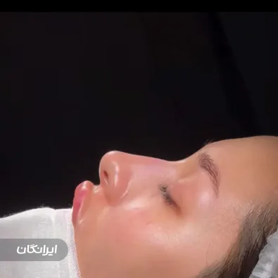 کلینیک زیبایی شاینا