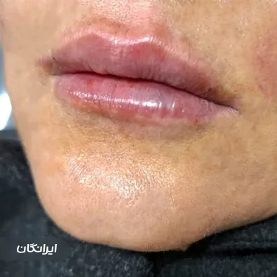 کلینیک زیبایی پاپیون