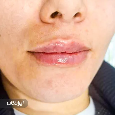 کلینیک زیبایی پاپیون