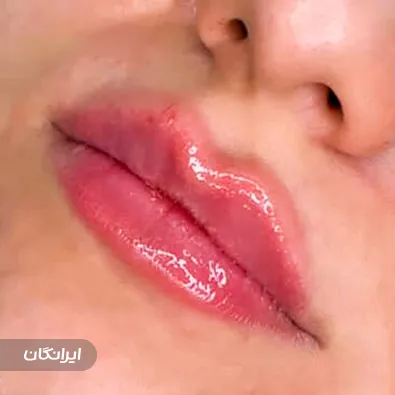 کلینیک زیبایی پاپیون