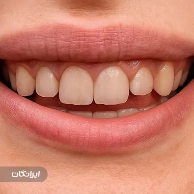 دندانپزشکی راز لبخند