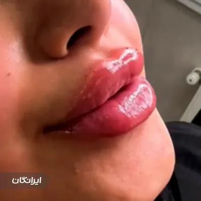 کلینیک زیبایی دکتر ندا ابراهیمی فر