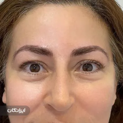 سالن آرایش دائم الهه رضایی