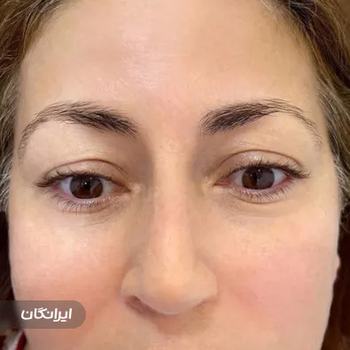 سالن آرایش دائم الهه رضایی