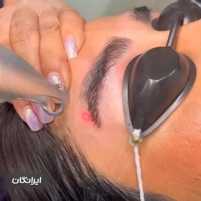 کلینیک زیبایی آیلین