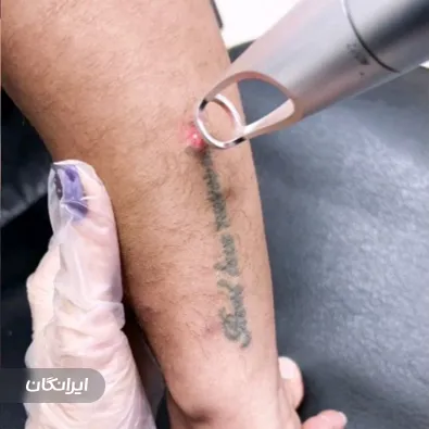 کلینیک زیبایی آیلین