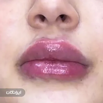 کلینیک زیبایی مانلی