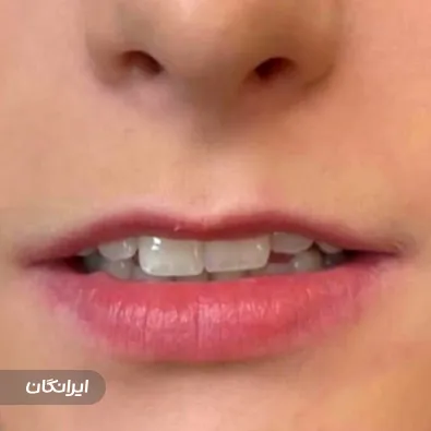 کلینیک زیبایی آیسونا