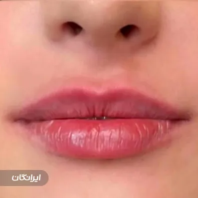 کلینیک زیبایی آیسونا