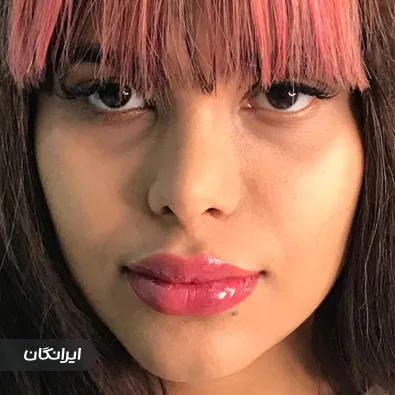 کلینیک زیبایی آیسونا