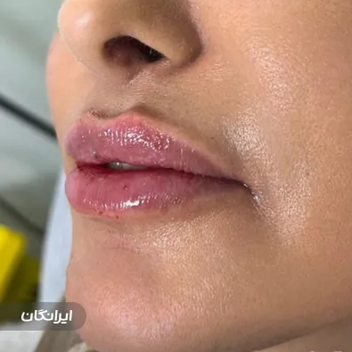 کلینیک زیبایی بنیتا