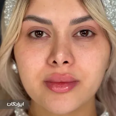 سالن زیبایی رازمنا