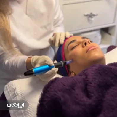 فیشیالیست سعیده انوری