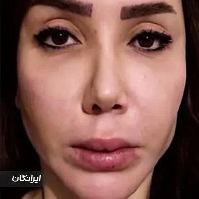 کلینیک زیبایی ثنا