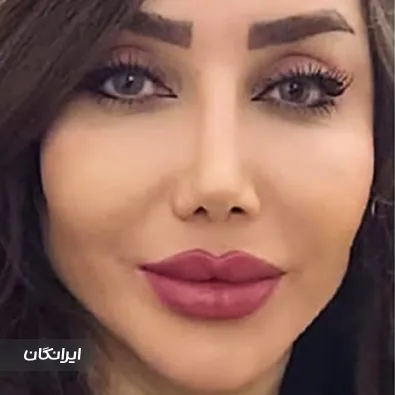 کلینیک زیبایی ثنا