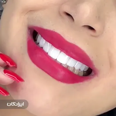 دندانپزشکی الماس