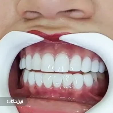 دندانپزشکی الماس