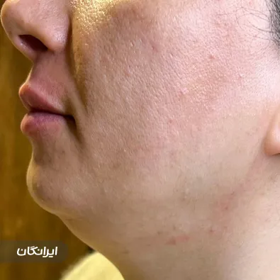 کلینیک زیبایی دکتر نیکا مجاهد یزدی