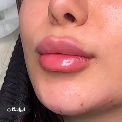 کلینیک زیبایی دکتر مهدیه حسین زاده