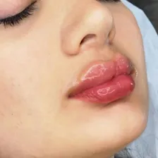 کلینیک زیبایی ری رویال