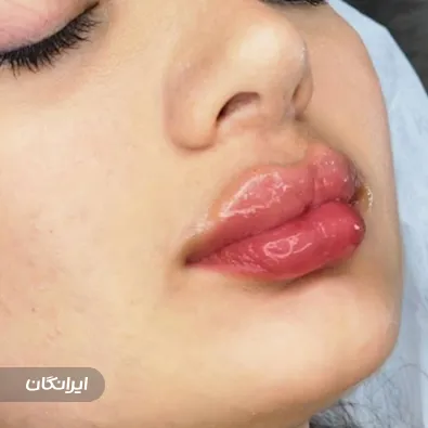 کلینیک زیبایی ری رویال