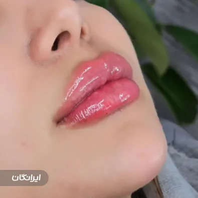 کلینیک زیبایی ری رویال