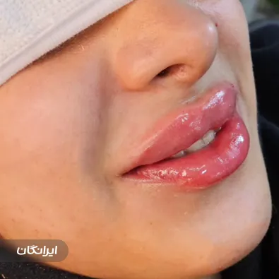 کلینیک زیبایی ری رویال