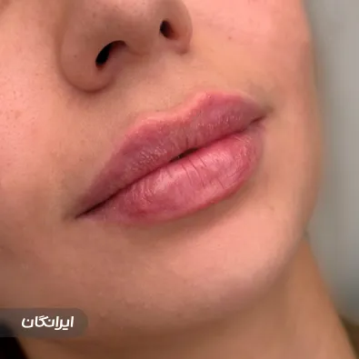 کلینیک زیبایی پوستینو