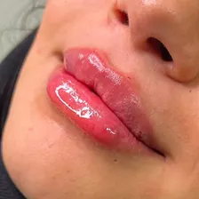 کلینیک زیبایی پوستینو