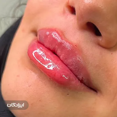 کلینیک زیبایی پوستینو